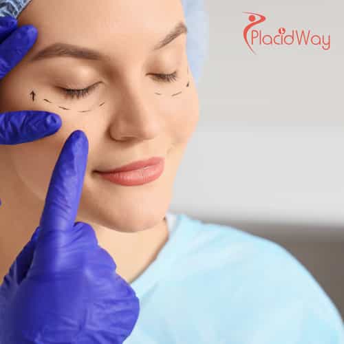 Exploring Thailand for Eyelid Surgery: A Popular Option for New Zealanders